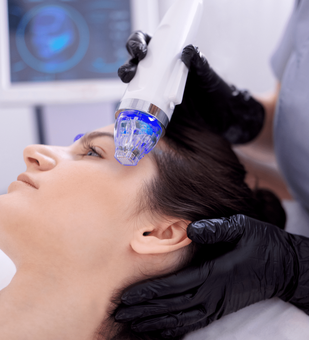 Gold Microneedling Treatment
