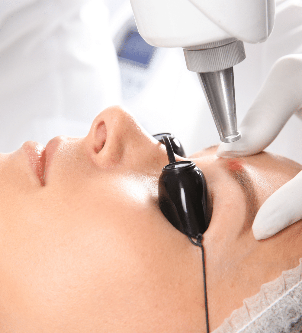 Eyebrow Tattoo Removal with Pico Laser Technology